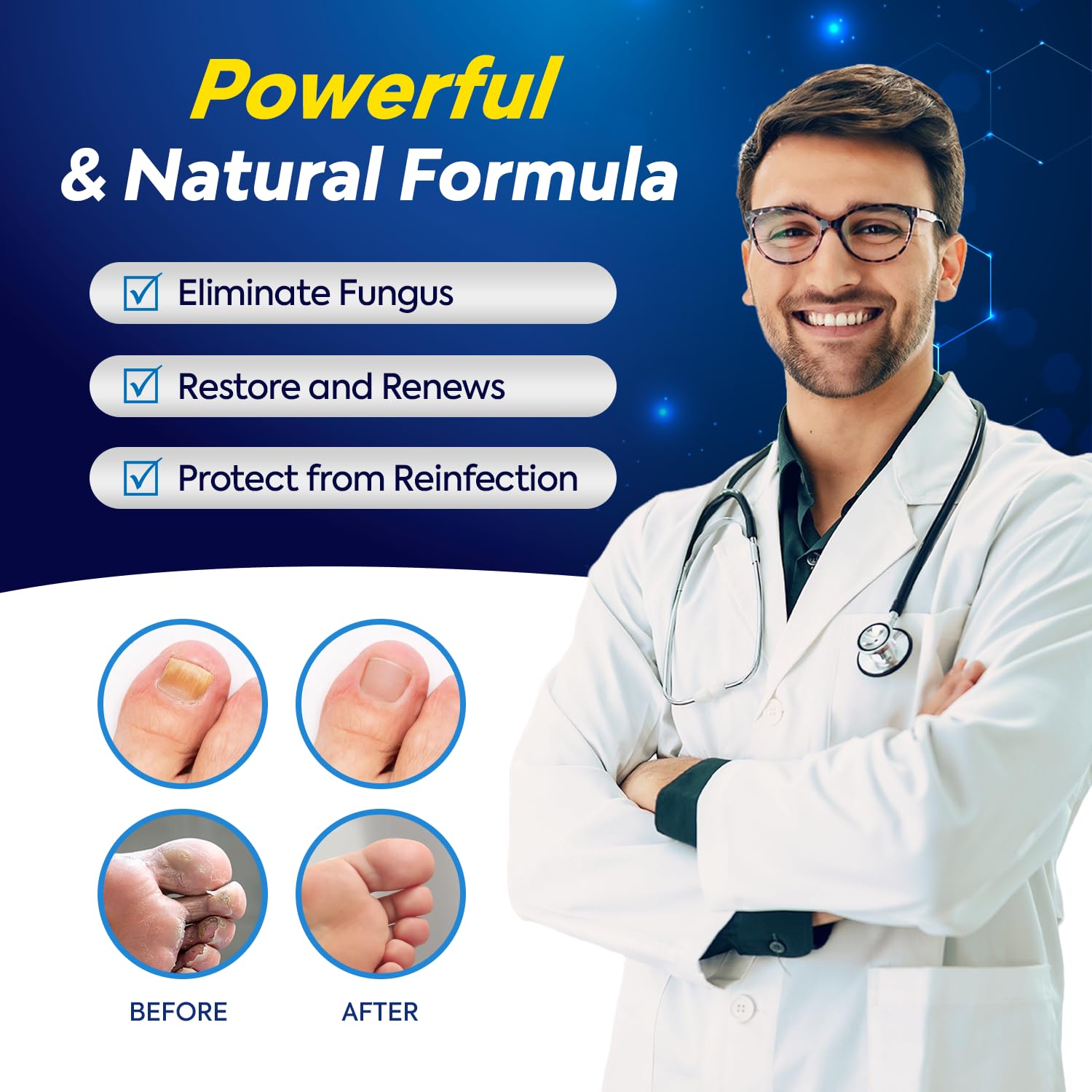 Toenail Fungus Treatment with 25% Undecylenic Acid, Toe Fungus Treatment for Toenail, Fungus Nail Treatment, Toenail Fungus Treatment Extra Strength, Fungal Nail Treatment for Athletes Foot - 2pcs