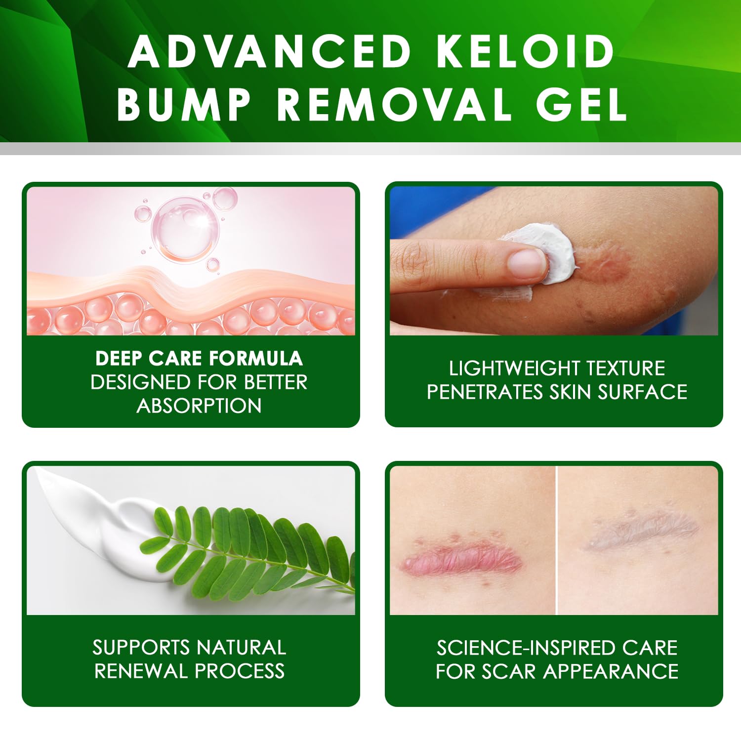 Advanced Keloid Bump Removal Gel (3 Packs): Silicone Keloid Scar Removal Cream for Scars from Piercing, Surgical Marks, Acne, and Burns, Keloid Treatment for Ears, Face, and Body with Healing Formula