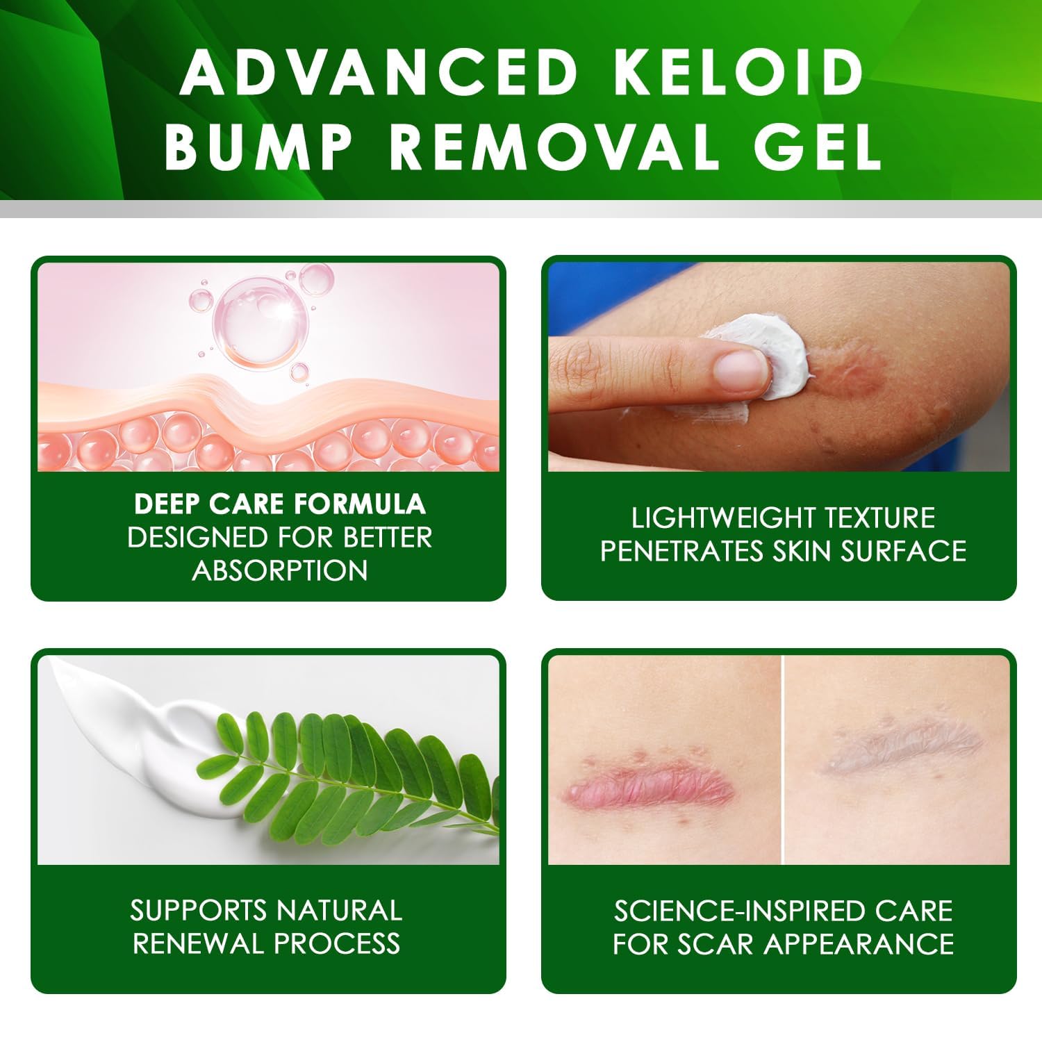 Advanced Keloid Bump Removal Gel: Silicone Keloid Scar Removal Cream for Scars from Piercing, Surgical Marks, Acne, and Burns, Keloid Treatment for Ears, Face, and Body with Healing Formula 30g